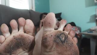 Dirty feet and smoking