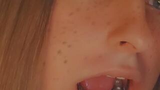 GlitterGiiiirl´s Braces & Palatal Bar Up Close: Inserting and Removing My Loose Retainer with Brackets – Detailed Close-Up with wig