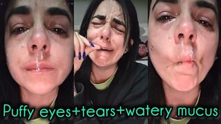 Puffy eyes+tears+watery mucus!