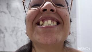 LOOK AT MY MOUTH, CROOKED TEETH, TONGUE AND BUBBLE GUM