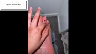 Itchymimis quick public itch then at home itching