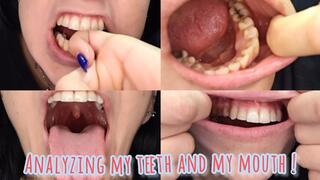 Analyzing my teeth and my mouth !