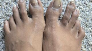 Wanna Suck My Nasty Toes Before My Pedicure?? These Corns Make A Great Tongue Scraper!