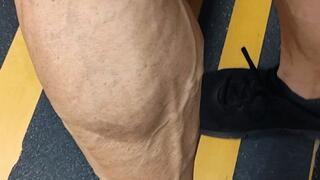 Tempest on stairs and using mirrors