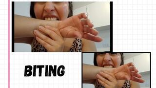 Biting fetish