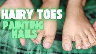Hairy toes: showing and painting my nailtoes