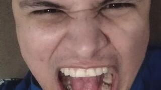 Silly dude doing stupid scary faces and showing my teeth