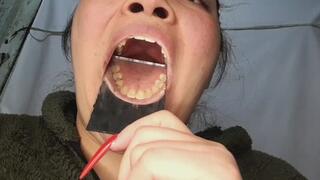 “Smile of Shame – My Yellow Teeth Up Close Just for You”