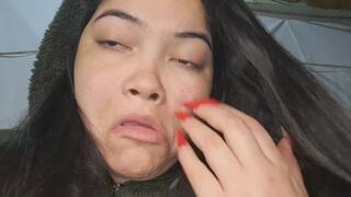 Intense Coughing Fit – I Almost Puke with My Mouth Twisted