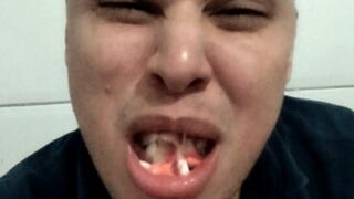 Giant eats the gummy teeth of his enemies and makes silly scary faces