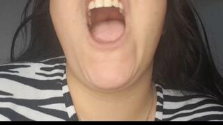 Explore Jessie's Stinky Morning Mouth - Bad Breath