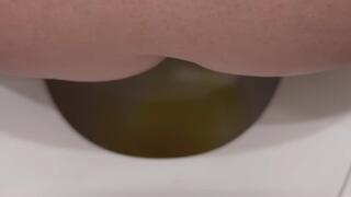 Kennedy Daily Urination