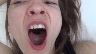 HORRIBLE MORNING BAD BREATH 4 M