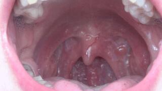 ORAL CAVIT CLOSE UP TO THE CAMERA 5 M