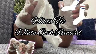 White Toe White Sock Removal
