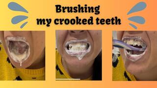 BRUSHING MY CROOKED TEETH
