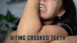 Crooked teeth biting hairy arms
