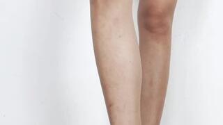 Flattened and inserted