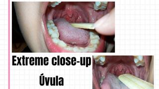 INSPECTING MY LITTLE ÚVULA