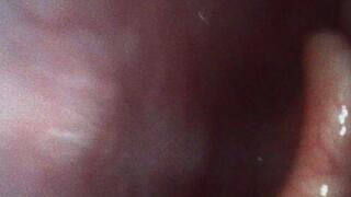 Katja Endoscopic Mouth Tour