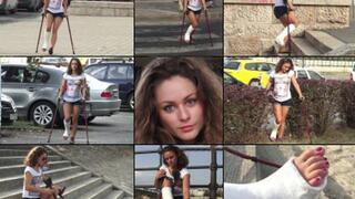 Zuzu Term SLWC Summer Crutch and Unexpected Sunburn with Foot Play (in HD 1920X1080