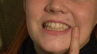 Close Up Finger Biting