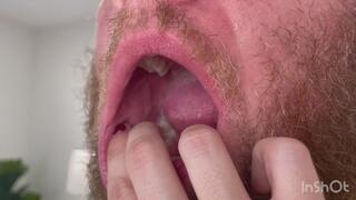 Vincent in vore checkup with Ziva Fey