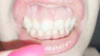 My gums are inflamed