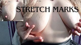 Stretch marks on saggy, natural breasts