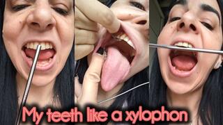My teeth sound like a xylophone !