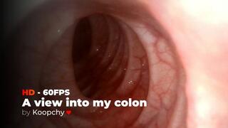 [HD 60 FPS] - A view into Koopchy's colon - ENDOSCOPE VORE