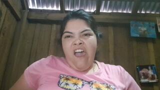 Jessie yawns for a whole week, her mouth hurts a lot