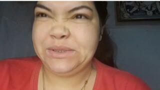 A week with disgusting bad breath - super stinky mouth