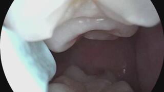 Stuck in Her Mouth – Micro POV Between Her Teeth After Lunch