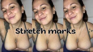 Stretch mark fetish