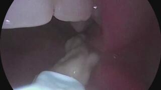 Inside Her Mouth – Chewed, Spit, and Stuck to Her Gym Shoe