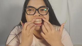Woman with glasses shows you how her yellow teeth look