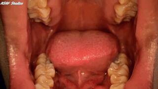 Mouth and Uvula views - MP4