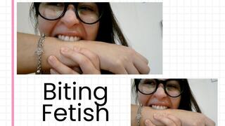 Biting me, marking my skin