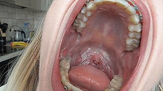 Big mouth wants you! MP4