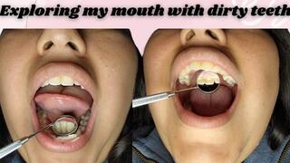 Exploring my dirty teeth with my new mouth mirror