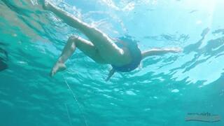 375 - Tricia got a Sunstroke!