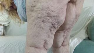 VID BJMature Bruised Bum