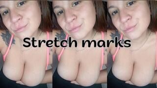 Stretch marks on my tits