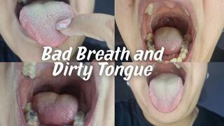 Bad Breath and Dirty Tongue closeup