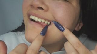 Deep examination of my entire mouth - wanna look?