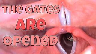 Endoscope Exploration in Freya's Mouth