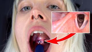 Tiny dentist examines Freya's guts