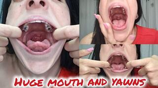 Huge mouth and yawns