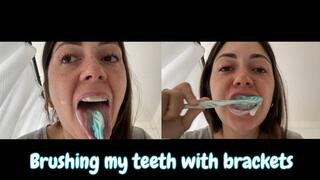 Brushing my teeth with brackets
